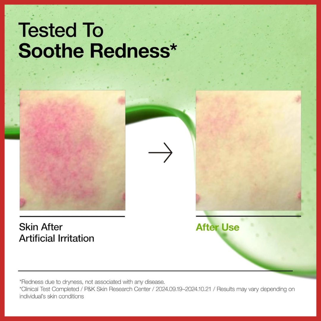 ANUA Azelaic Acid 10 Hyaluron Redness Soothing Serum 30ml