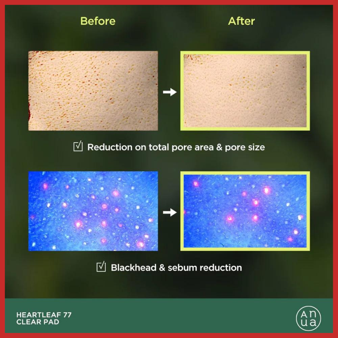 ANUA Heartleaf 77% Toner Pad 70 Sheets 160ml