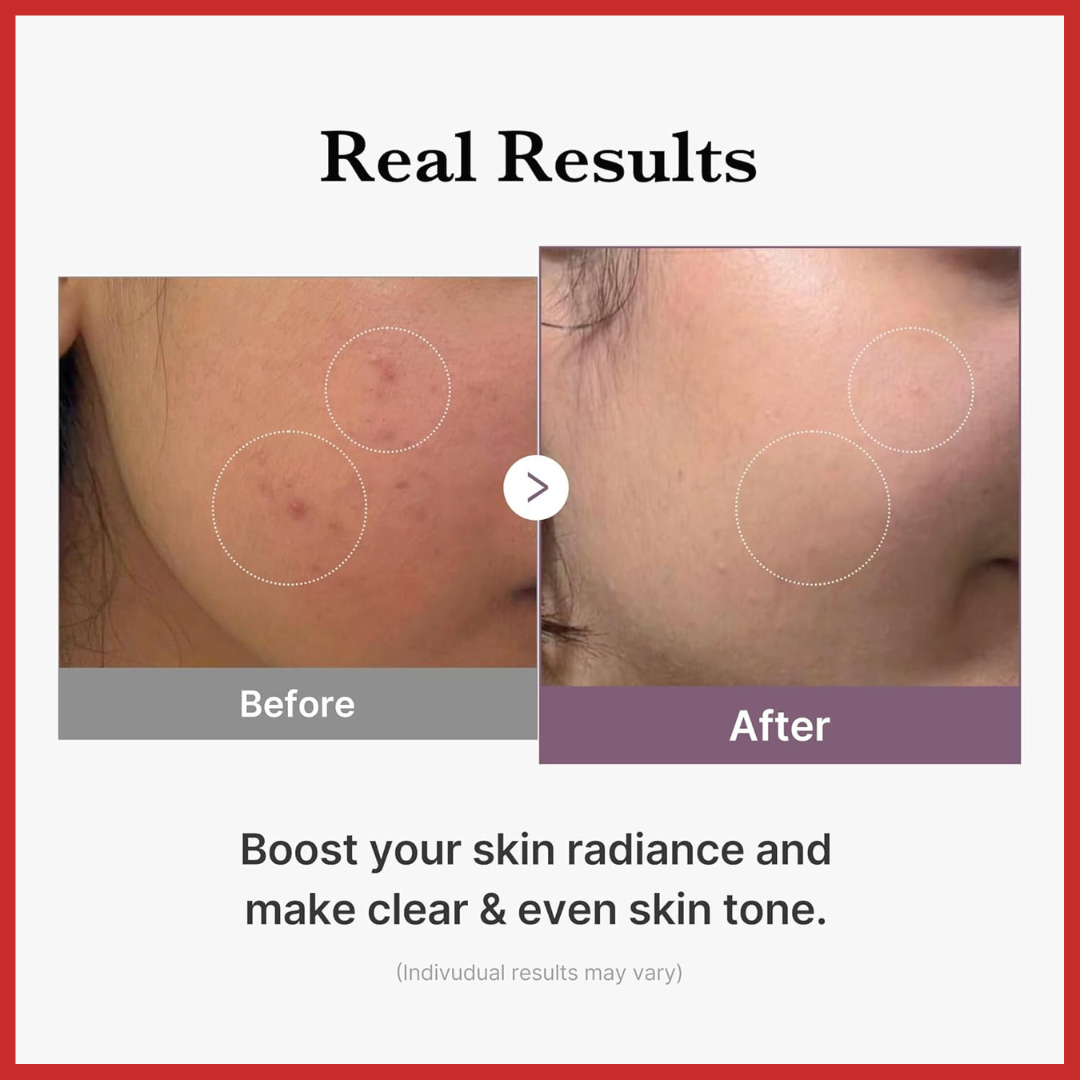 medicube AGE-R Glutathione Glow Toner 140ml