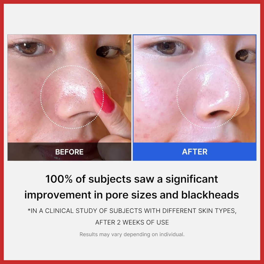 Medicube Zero Pore Pad 2.0