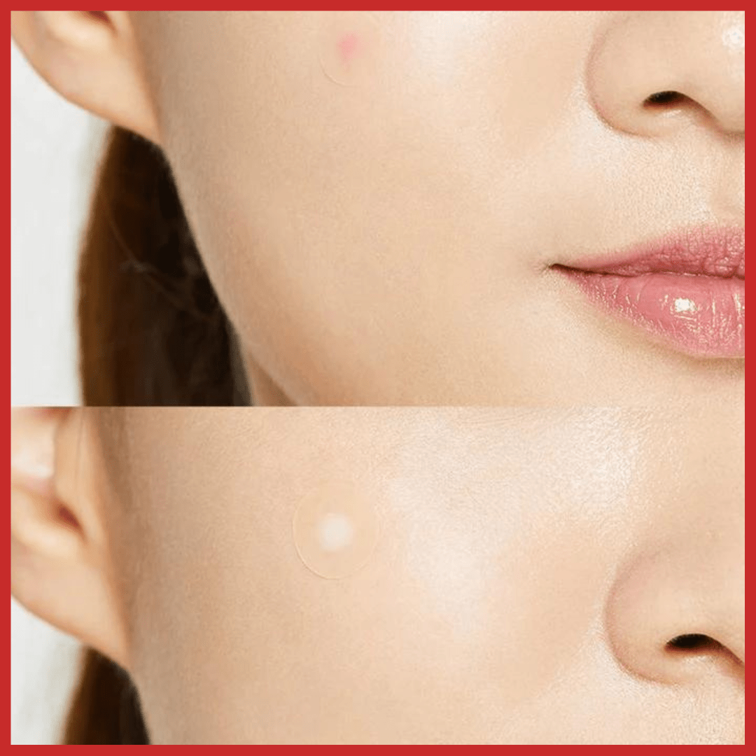 COSRX Acne Pimple Master Patch