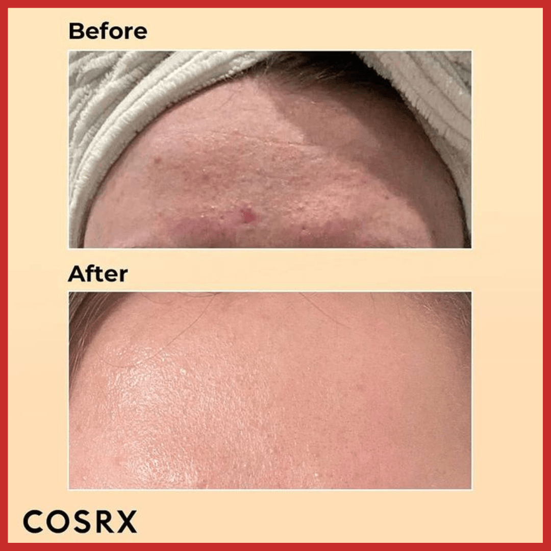 COSRX Advanced Snail 96 Mucin Power Essence 100ml