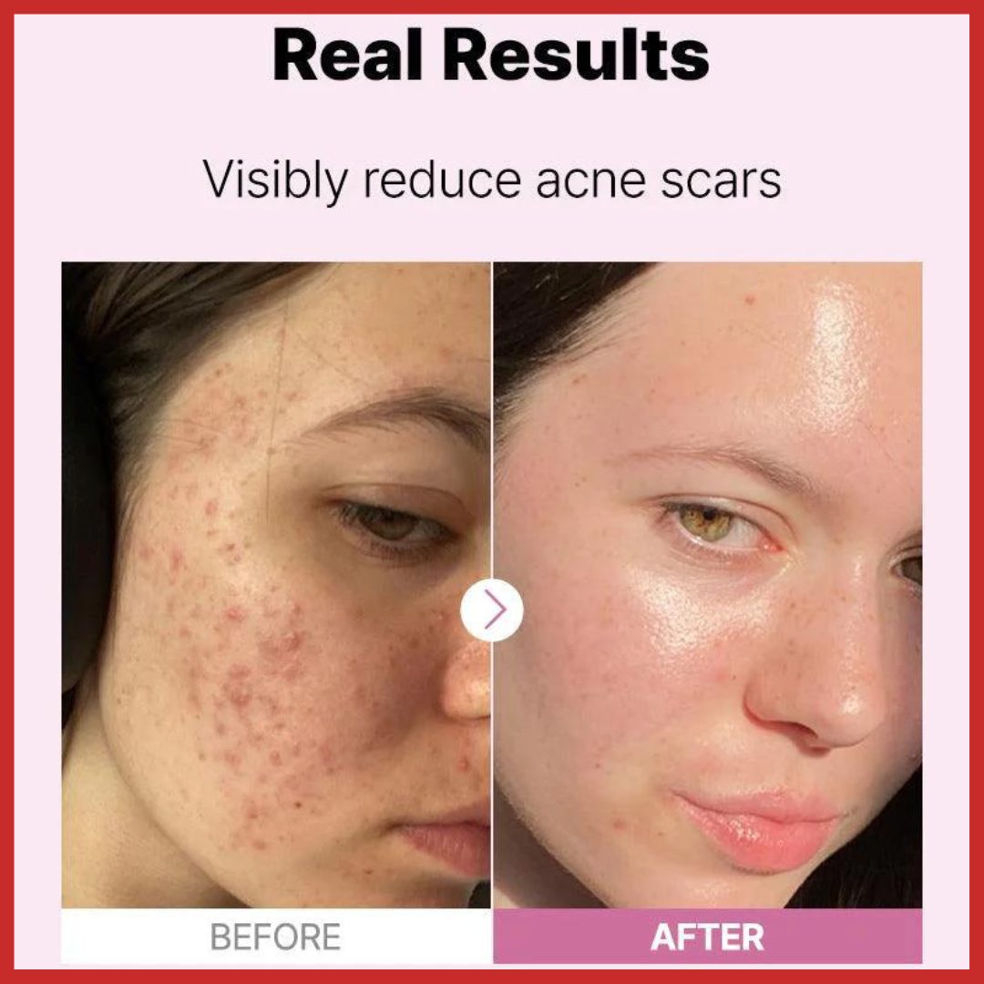 COSRX The Niacinamide 15 Serum 20ml