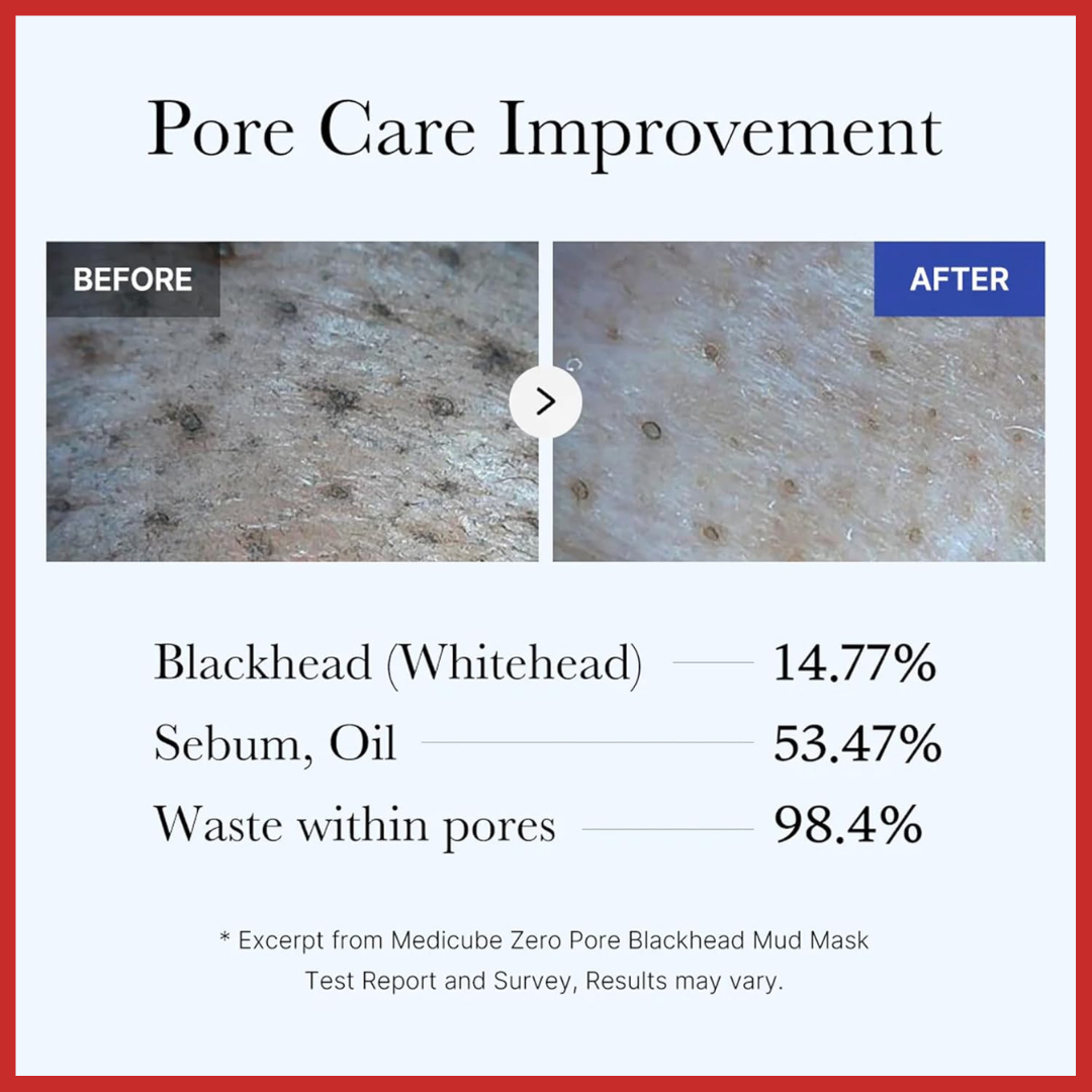 medicube Zero Pore Blackhead Mud Facial Mask 100ml